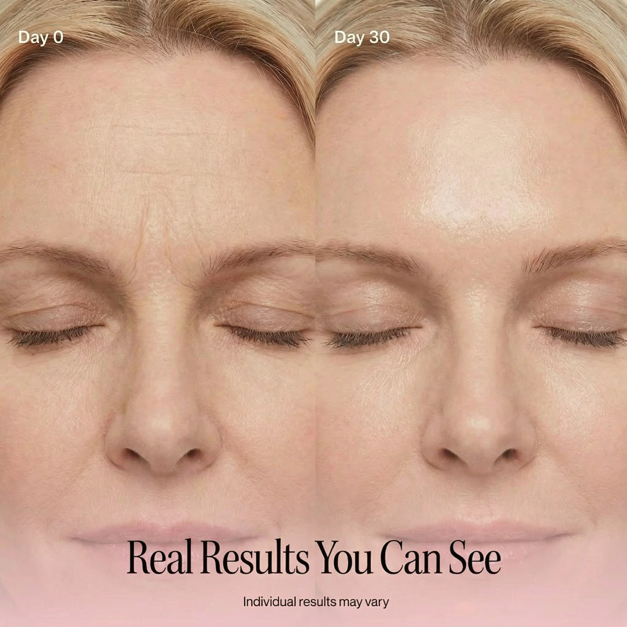 LumaTique® Red Light Therapy Wand